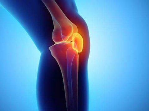 Slitgigtarnámskeið